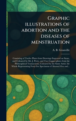 Graphic Illustrations of Abortion and the Diseases of Menstruation - Granville, A B (Augustus Bozzi)