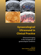 Gynaecological Ultrasound in Clinical Practice: Ultrasound Imaging in the Management of Gynaecological Conditions