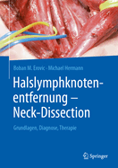 Halslymphknotenentfernung - Neck-Dissection: Grundlagen, Diagnostik, Therapie