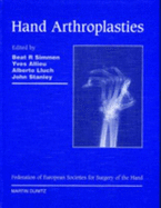 Hand Arthroplasties: Published in Association with the Federation of European Societies for Surgery of the Hand - Allieu, Yves, and Lluch, Alberto, and Simmen, Beat R