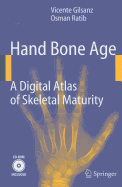Hand Bone Age: A Digital Atlas of Skeletal Maturity