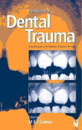 Handbook of Dental Trauma - Curzon, M E J