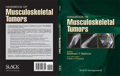 Handbook of Musculoskeletal Tumors - Wallace, Matthew, and Frassica, Frank