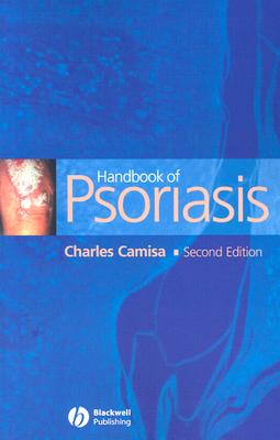 Handbook of Psoriasis - Camisa, Charles, M.D.