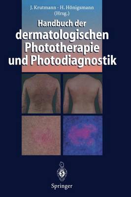 Handbuch Der Dermatologischen Phototherapie Und Photodiagnostik - Krutmann, Jean (Editor), and Hnigsmann, Herbert (Editor)