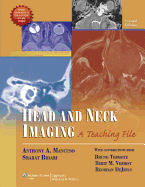 Head and Neck Imaging: A Teaching File