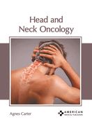 Head and Neck Oncology