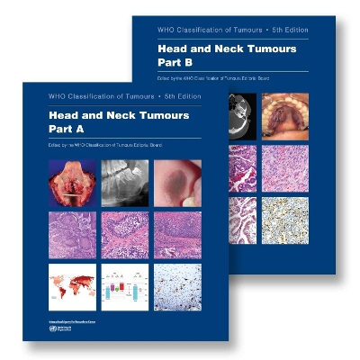 Head and Neck Tumours: Who Classification of Tumours - Who Classification of Tumours Editorial Board (Editor)