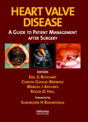 Heart Valve Disease: A Guide to Patient Management After Surgery - Butchart, Eric G (Editor), and Gohllke-Barwolf, Christa (Editor), and Antunes, Manuel (Editor)