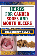 Herbs for Canker Sores and Mouth Ulcers: Soothing Remedies, Harnessing Wisdom To Relieve Nature's Bounty Through Effective Strategies