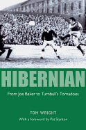 Hibernian: From Joe Baker to Turnbull's Tornadoes