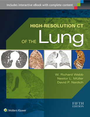 High-Resolution CT of the Lung - Webb, W Richard, and Muller, Nestor L, and Naidich, David P