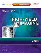 High-Yield Imaging: Chest: Expert Consult - Online and Print