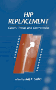 Hip Replacement: Current Trends and Controversies