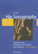 Hip Sonography: Diagnosis and Management of Infant Hip Dysplasia