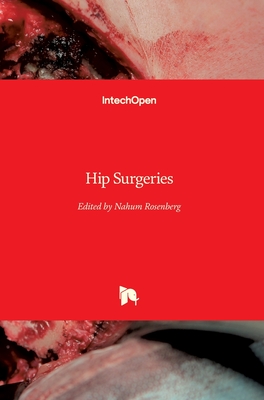 Hip Surgeries - Rosenberg, Nahum (Editor)