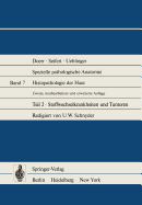 Histopathologie Der Haut: Stoffwechselkrankheiten Und Tumoren