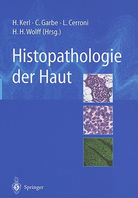 Histopathologie Der Haut - Kerl, Helmut, M.D. (Editor), and Garbe, Claus (Editor), and Wolff, Helmut H (Editor)