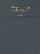 Histopathology of the Liver