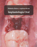 Histora clnica y exploracin en Implantologa Oral