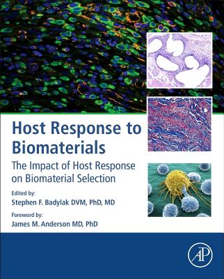 Host Response to Biomaterials: The Impact of Host Response on Biomaterial Selection - Badylak, Stephen F (Editor)