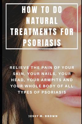 How to Do Natural Treatments for Psoriasis: Relieve the Pain of Your Skin, Your Nails, Your Head, Your Armpits and Your Whole Body of All Types of Psoriasis - Brown, Jessy M