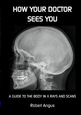 How Your Doctor Sees You - Angus, Robert
