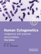 Human Cytogenetics: A Practical Approachvolume 2: Malignancy and Acquired Abnormalities