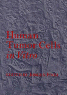 Human Tumor Cells in Vitro - Fogh, Jrgen, and Fogh, Jorgen (Editor)