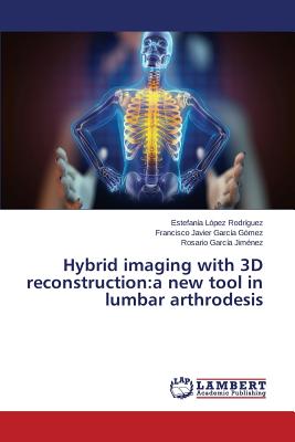 Hybrid imaging with 3D reconstruction: a new tool in lumbar arthrodesis - Lpez Rodrguez Estefana, and Garca Gmez Francisco Javier, and Garca Jimnez Rosario