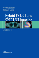 Hybrid PET/CT and SPECT/CT Imaging: A Teaching File