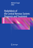 Hydatidosis of the Central Nervous System: Diagnosis and Treatment