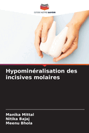 Hypominralisation des incisives molaires