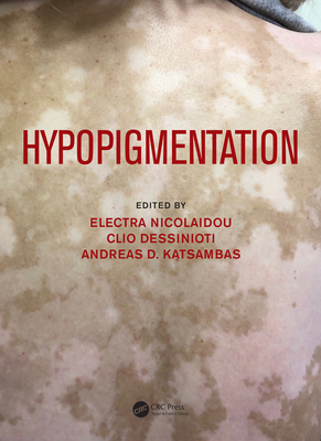 Hypopigmentation - Nicolaidou, Electra (Editor), and Dessinioti, Clio (Editor), and Katsambas, Andreas (Editor)