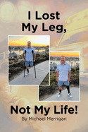 I Lost My Leg, Not My Life!