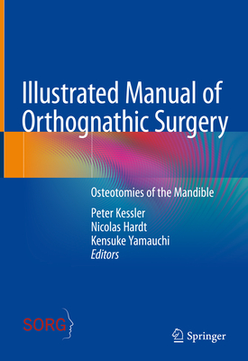 Illustrated Manual of Orthognathic Surgery: Osteotomies of the Mandible - Kessler, Peter (Editor), and Hardt, Nicolas (Editor), and Yamauchi, Kensuke (Editor)