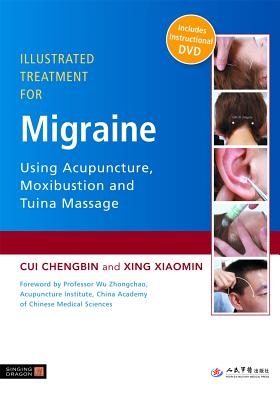 Illustrated Treatment for Migraine Using Acupuncture, Moxibustion and Tuina Massage - Chengbin, Cui, and Xiaomin, Xing