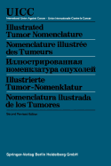 Illustrated Tumor Nomenclature / Nomenclature Illustr?e Des Tumeurs / &#1048;&#1083;&#1083;&#1102;&#1089;&#1090;&#1088;&#1080;&#1088;&#1086;&#1074;&#1072;&#1085;&#1085;&#1072;&#1103; &#1085;&#1086;&#1084;&#1077;&#1085;&#1082;&#1083;&#1072;&#1090;&#1091...