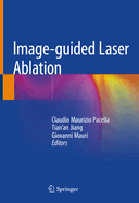 Image-Guided Laser Ablation