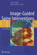 Image-Guided Spine Interventions