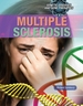 Multiple Sclerosis