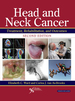 Head and Neck Cancer: Treatment, Rehabilitation, and Outcomes