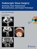 Endoscopic Sinus Surgery: Anatomy, Three-Dimensional Reconstruction, and Surgical Technique