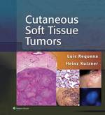 Cutaneous Soft Tissue Tumors