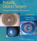 Pediatric Cataract Surgery