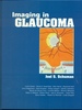 Imaging in Glaucoma