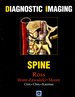 Diagnostic Imaging: Spine