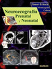 Neuroecograf'a Prenatal Y Neonatal