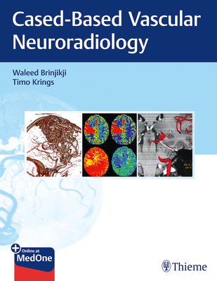 Imaging in Neurovascular Disease: A Case-Based Approach - Brinjikji, Waleed, and Krings, Timo