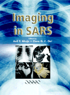Imaging in Sars